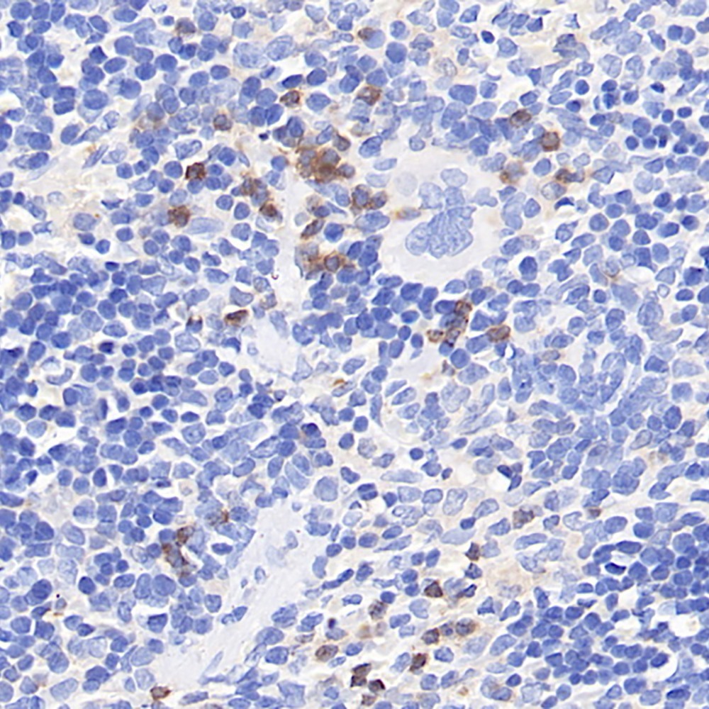 Immunohistochemistry analysis of paraffin-embedded rat spleen  using CYBB Polyclonal Antibody at dilution of 1:400.