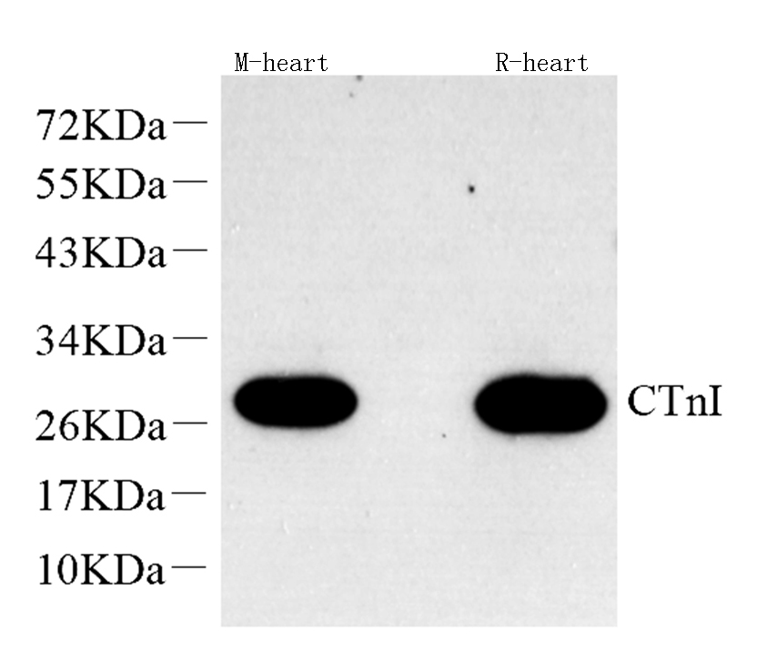 Western Blot analysis of various samples using TNNI3 Polyclonal Antibody at dilution of 1:600.
