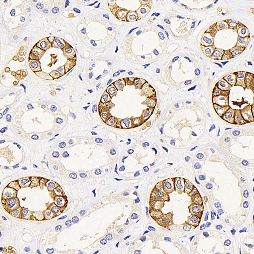 Immunohistochemistry analysis of paraffin-embedded human kidney  using AQP3 Polyclonal Antibody at dilution of 1:300.