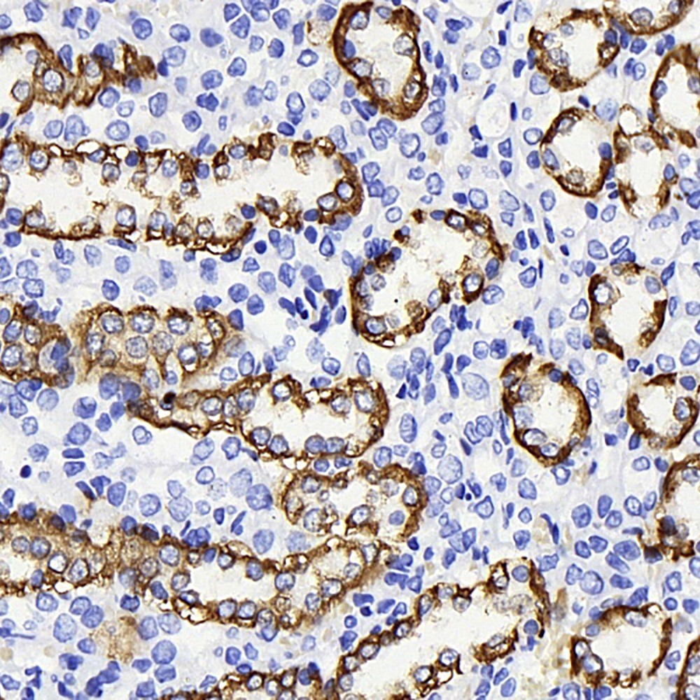 Immunohistochemistry analysis of paraffin-embedded rat kidney  using AQP3 Polyclonal Antibody at dilution of 1:300.