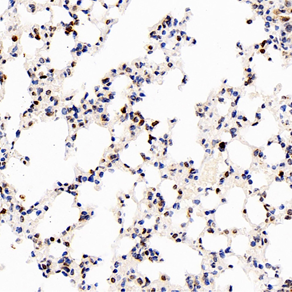 Immunohistochemistry analysis of paraffin-embedded Mouse lung  using S100A4 Polyclonal Antibody at dilution of 1:400.