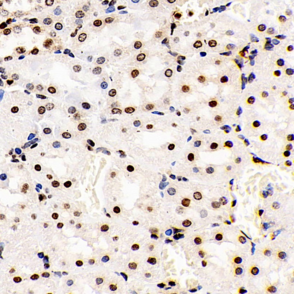 Immunohistochemistry analysis of paraffin-embedded Rat kidney  using S100A4 Polyclonal Antibody at dilution of 1:400.