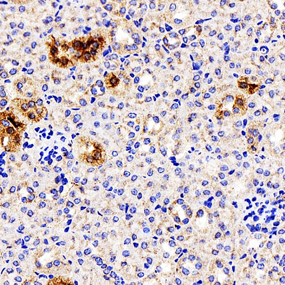 Immunohistochemistry analysis of paraffin-embedded mouse kidney  using ATG7 Polyclonal Antibody at dilution of 1:300.