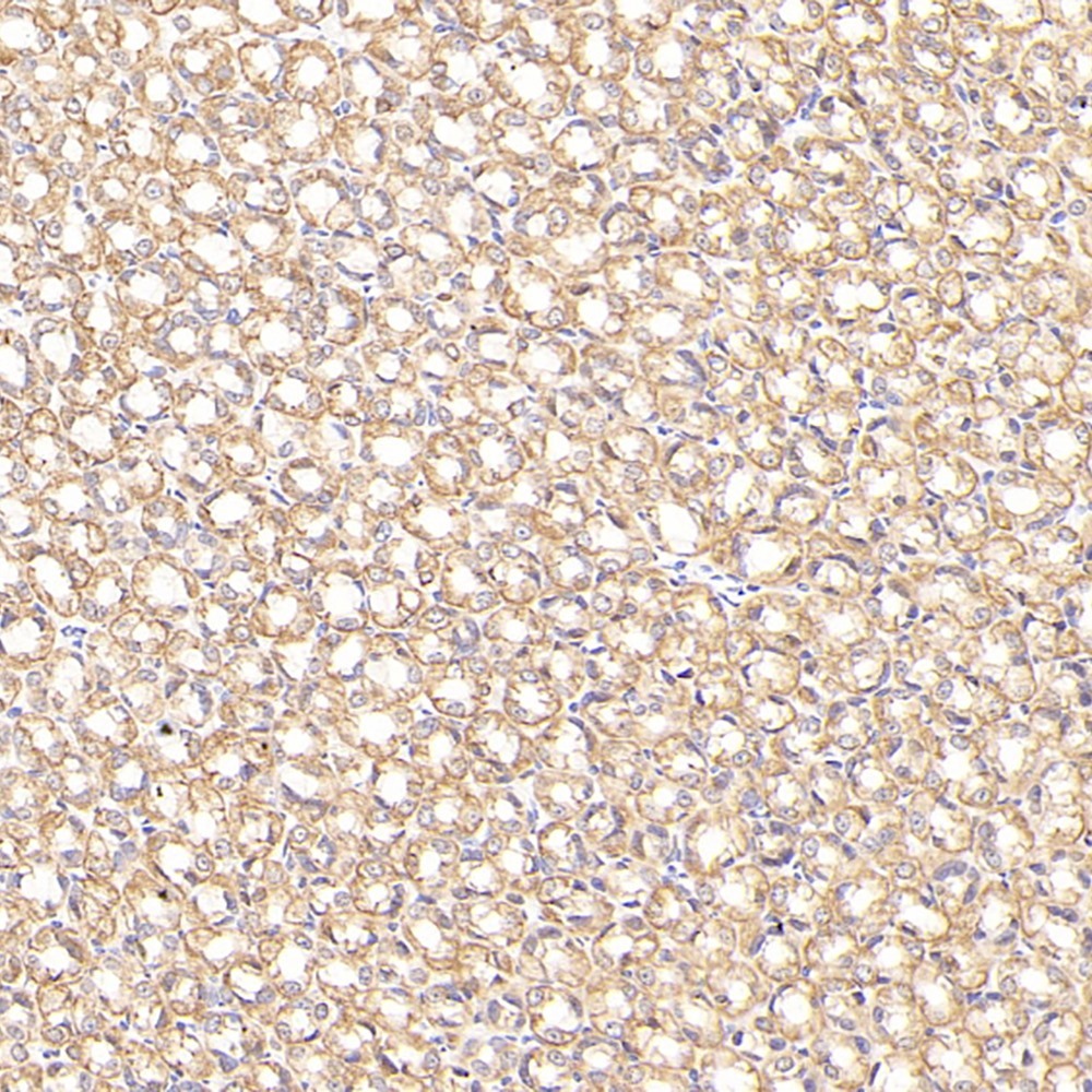 Immunohistochemistry analysis of paraffin-embedded Rat stomach cancer  using CK-7 Monoclonal Antibody at dilution of 1:300.