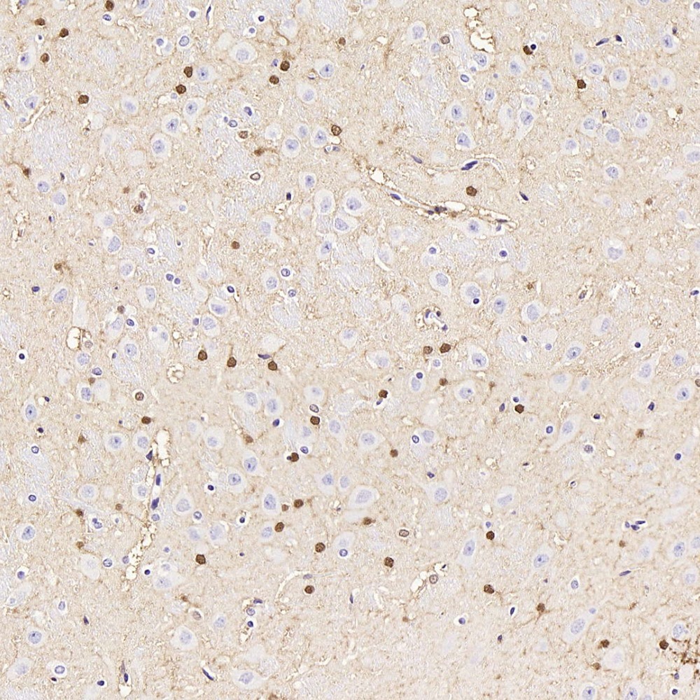 Immunohistochemistry analysis of paraffin-embedded rat brain  using S100B Polyclonal Antibody at dilution of 1:300.