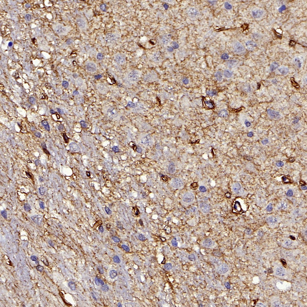 Immunohistochemistry analysis of paraffin-embedded rat brain  using DICER1 Polyclonal Antibody at dilution of 1:400.