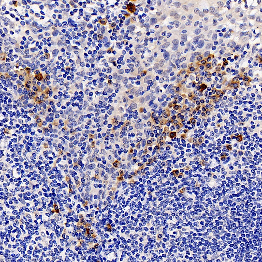 Immunohistochemistry analysis of paraffin-embedded human tonsil  using CASP1 Polyclonal Antibody at dilution of 1:300.