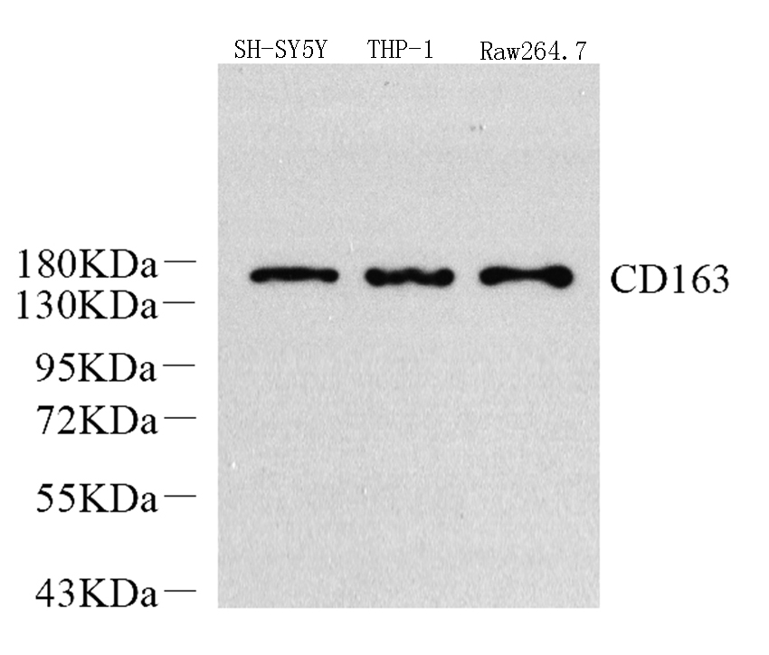 Western Blot analysis of various samples using CD163 Polyclonal Antibody at dilution of 1:1200.