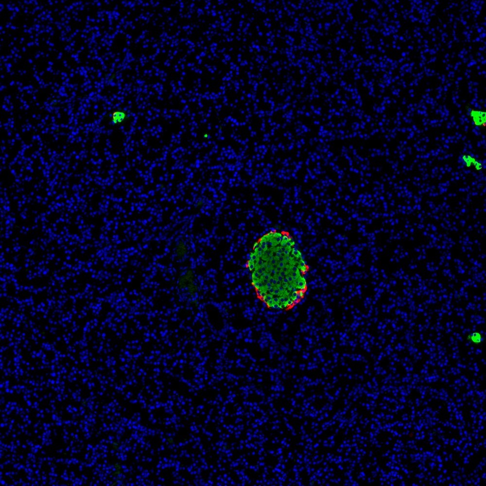 Immunofluorescence analysis of paraffin-embedded Rat pancreas  using GCG Polyclonal Antibody at dilution of 1:200.Red is labeled with glucagon antibody and green is labeled with insulin antibody.