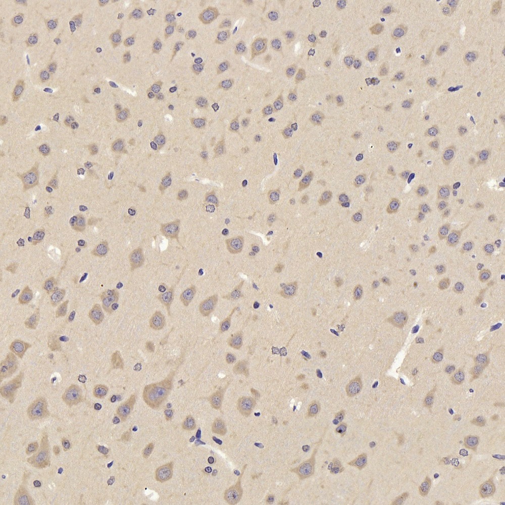 Immunohistochemistry analysis of paraffin-embedded rat cortex  using TAC1 Polyclonal Antibody at dilution of 1:300.