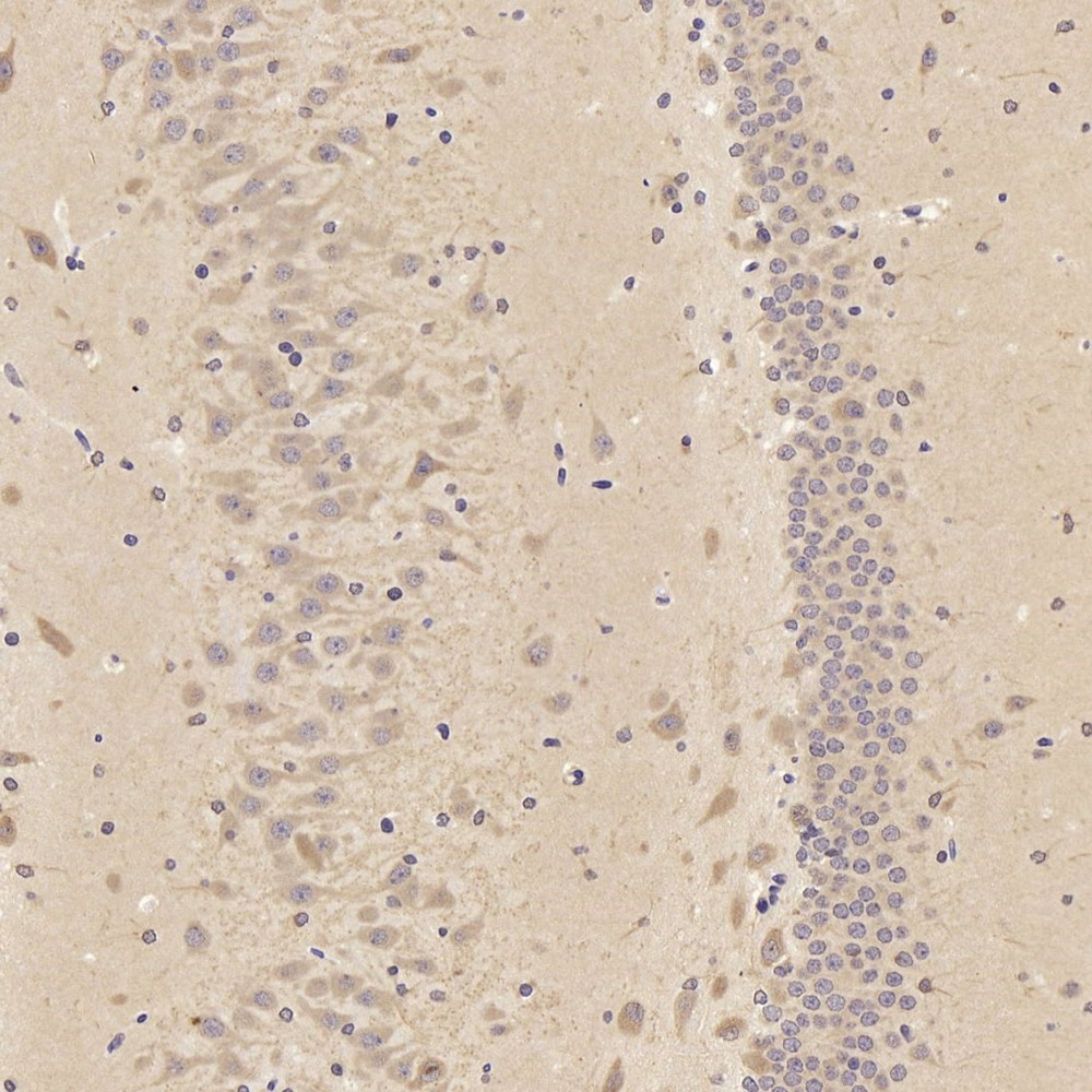 Immunohistochemistry analysis of paraffin-embedded rat Hippocampus   using TAC1 Polyclonal Antibody at dilution of 1:300.