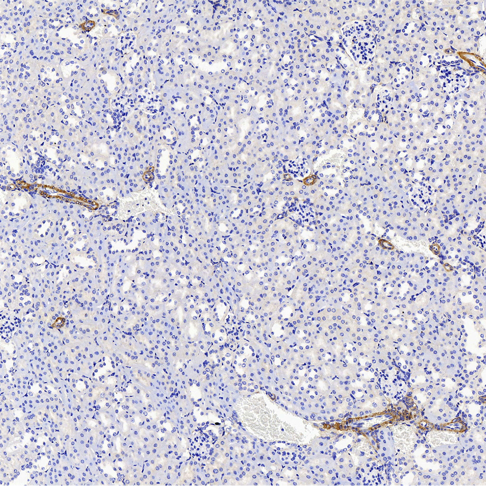 Immunohistochemistry (antigen was repair with 0.4% pepsin for 20 min) analysis of paraffin-embedded Mouse kidney using COL1A1 Polyclonal Antibody at dilution of 1:500.