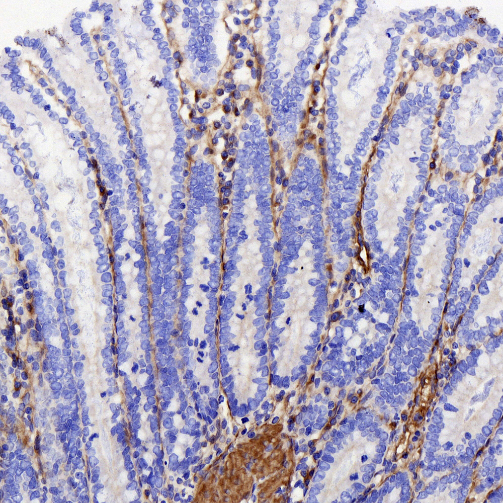 Immunohistochemistry (antigen was repair with 0.4% pepsin for 20 min) analysis of paraffin-embedded Rat colon  using COL1A1 Polyclonal Antibody at dilution of 1:500.