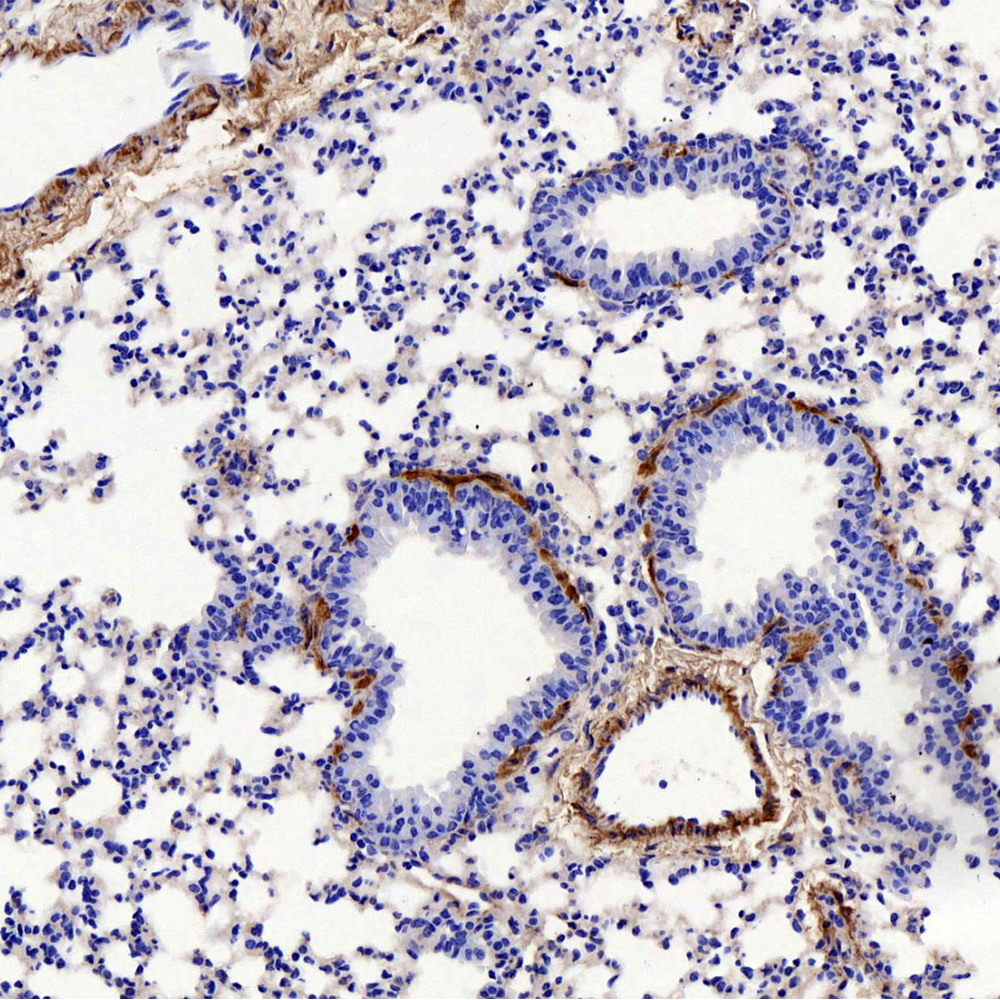 Immunohistochemistry (antigen was repair with 0.4% pepsin for 20 min) analysis of paraffin-embedded mouse lung  using COL1A1 Polyclonal Antibody at dilution of 1:500.