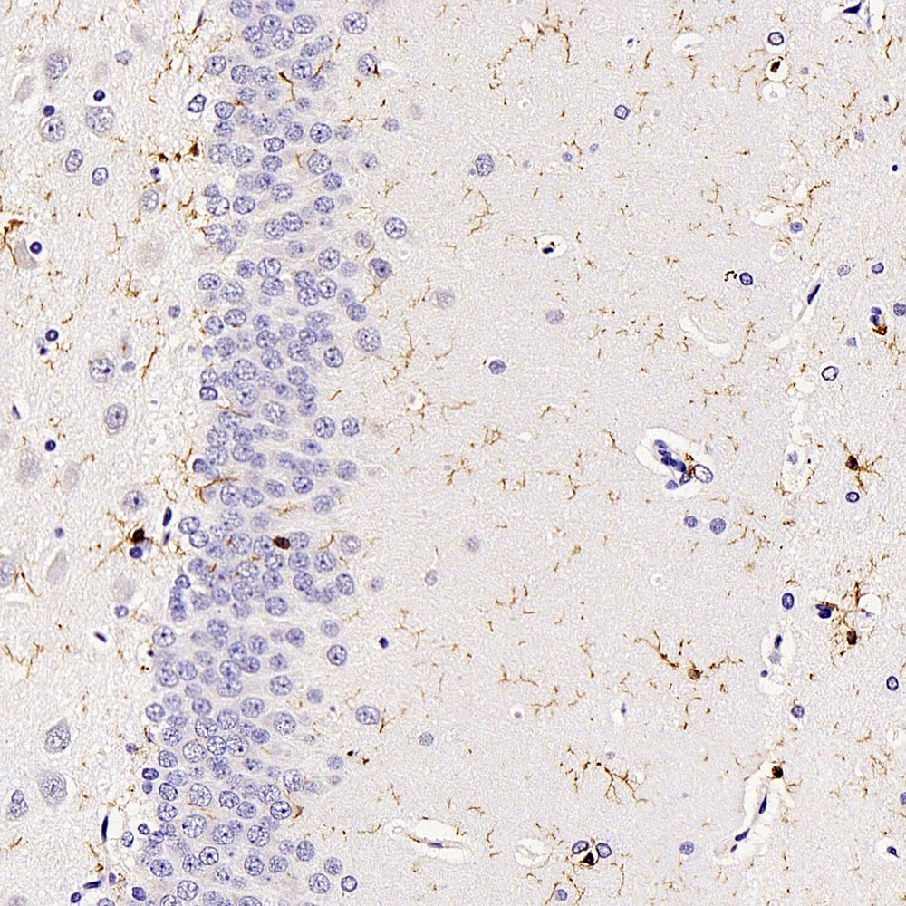 Immunohistochemistry analysis of paraffin-embedded Rat brain  using AIF1 Polyclonal Antibody at dilution of 1:300.