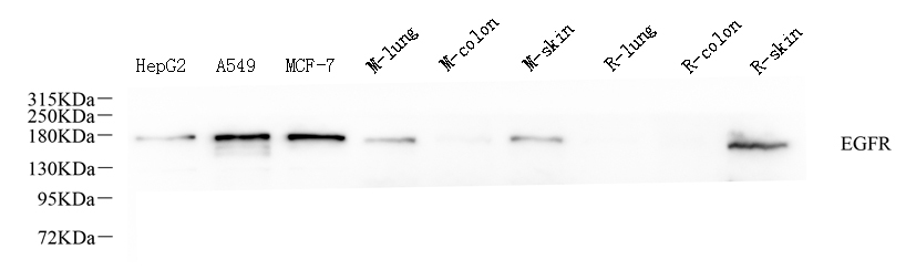 Western Blot analysis of various samples using EGFR Polyclonal Antibody at dilution of 1:1000.