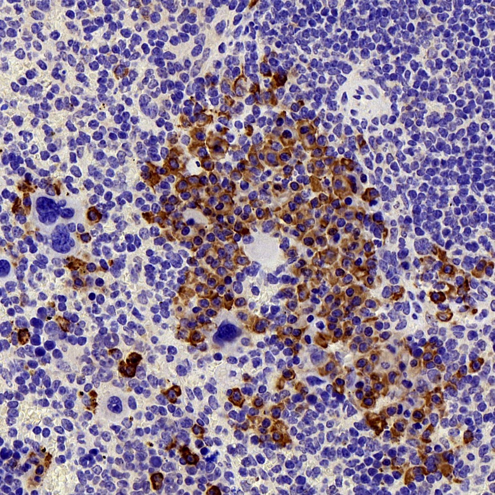 Immunohistochemistry analysis of paraffin-embedded mouse Immunized spleen  using FAS Polyclonal Antibody at dilution of 1:300.