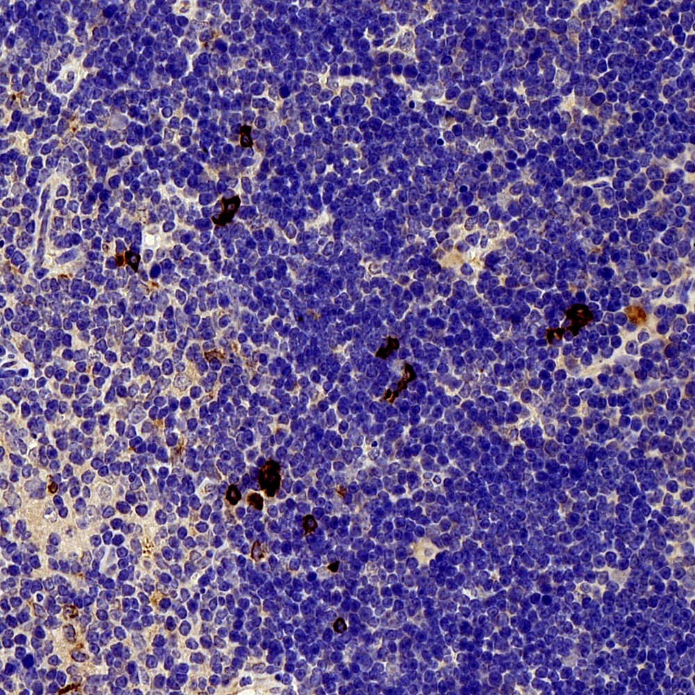 Immunohistochemistry analysis of paraffin-embedded mouse Immunized thymus  using FAS Polyclonal Antibody at dilution of 1:300.