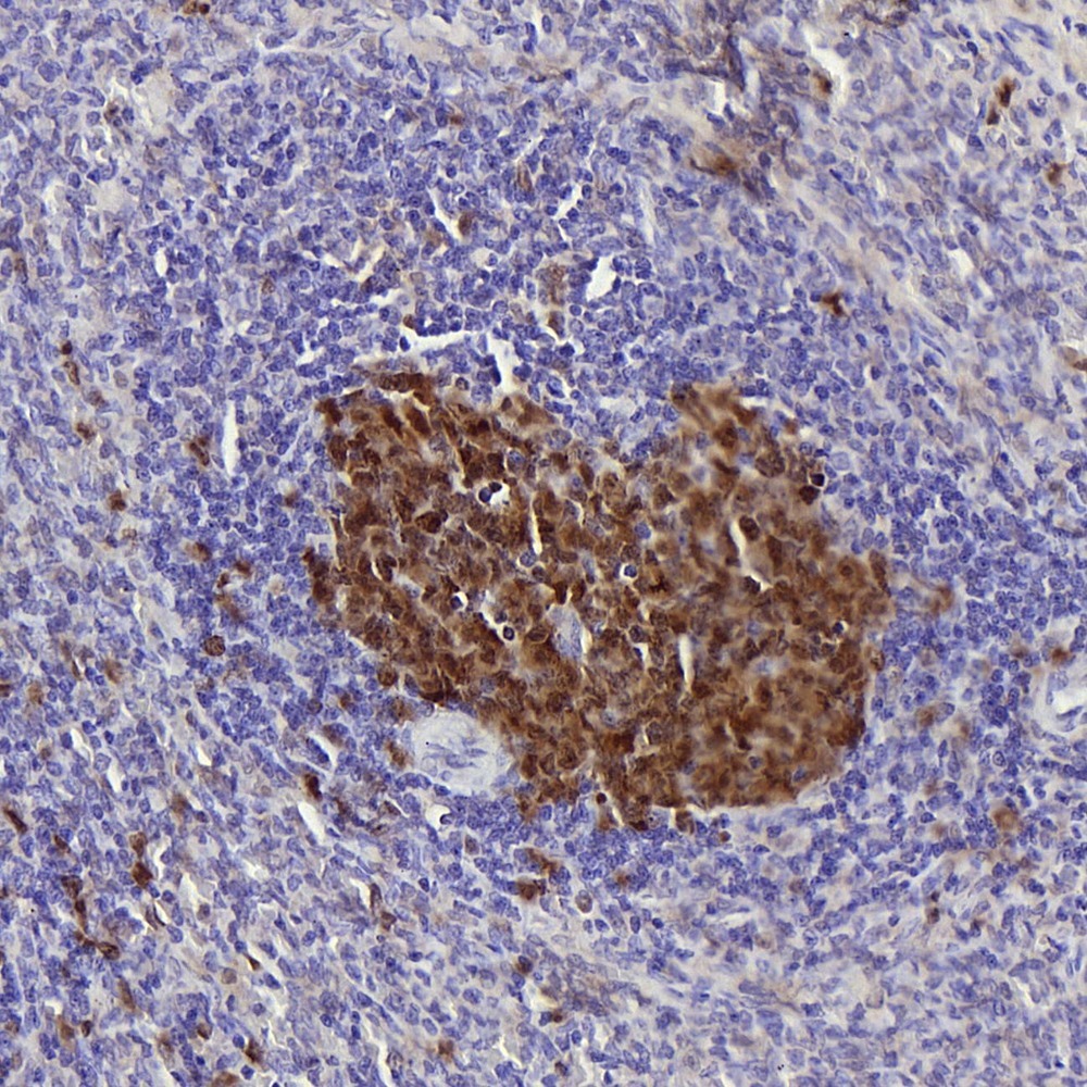 Immunohistochemistry analysis of paraffin-embedded rat spleen  using Survivin Polyclonal Antibody at dilution of 1:300.