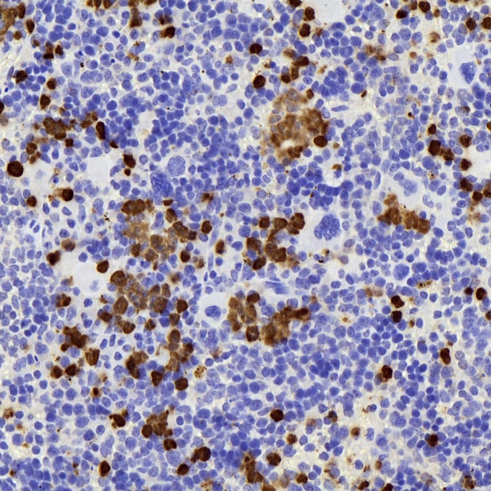 Immunohistochemistry analysis of paraffin-embedded mouse Immunized spleen  using S100A8 Polyclonal Antibody at dilution of 1:400.