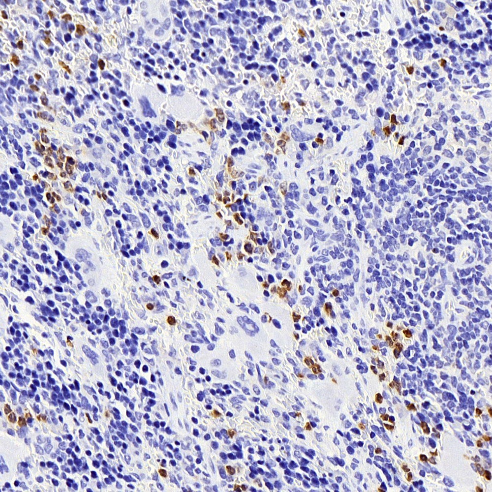 Immunohistochemistry analysis of paraffin-embedded rat spleen  using S100A8 Polyclonal Antibody at dilution of 1:400.