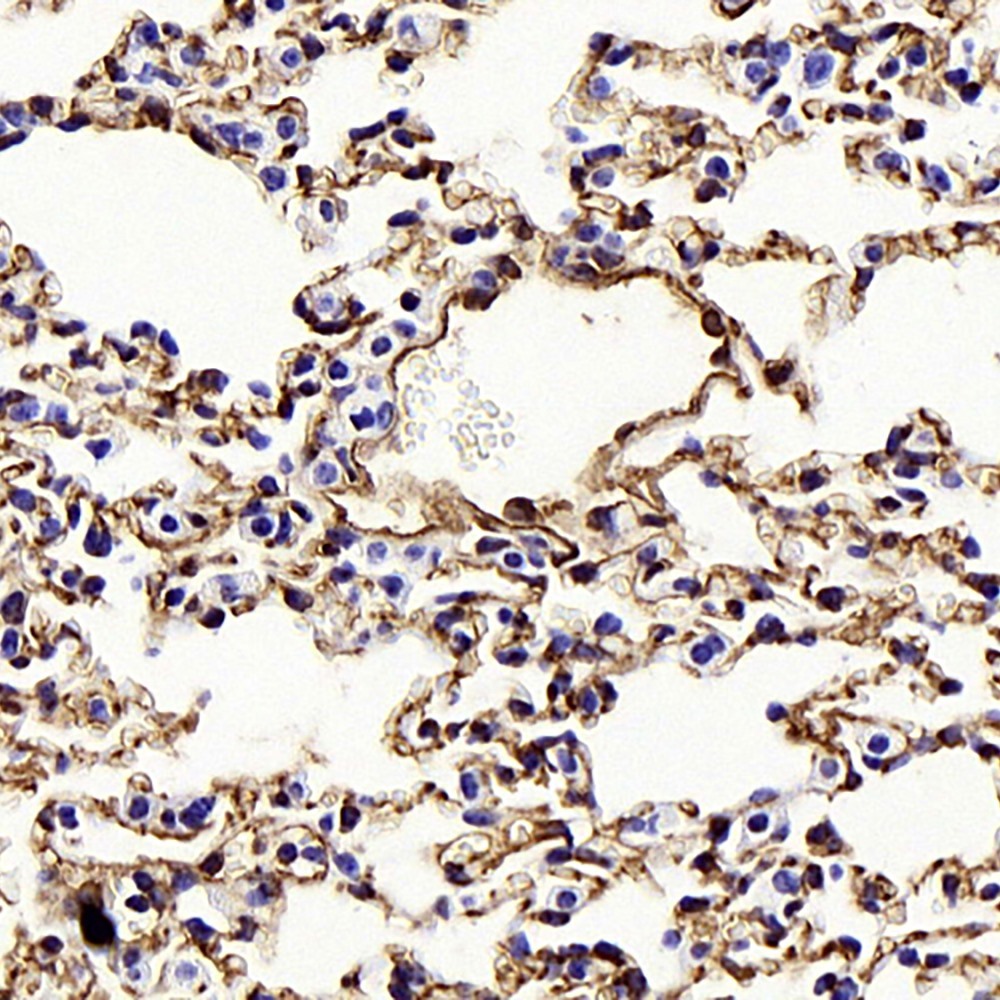 Immunohistochemistry analysis of paraffin-embedded mouse lung  using CAV1 Polyclonal Antibody at dilution of 1:1000.