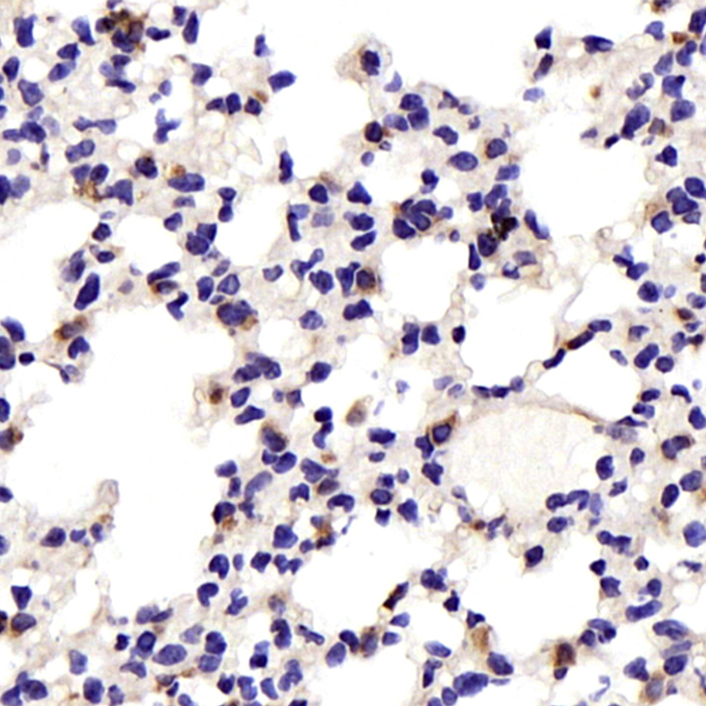 Immunohistochemistry analysis of paraffin-embedded Mouse lung  using JNK1/2/3 Polyclonal Antibody at dilution of 1:200.