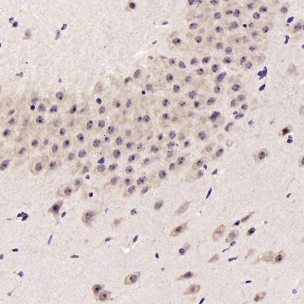 Immunohistochemistry analysis of paraffin-embedded Mouse brain  using JNK1/2/3 Polyclonal Antibody at dilution of 1:200.