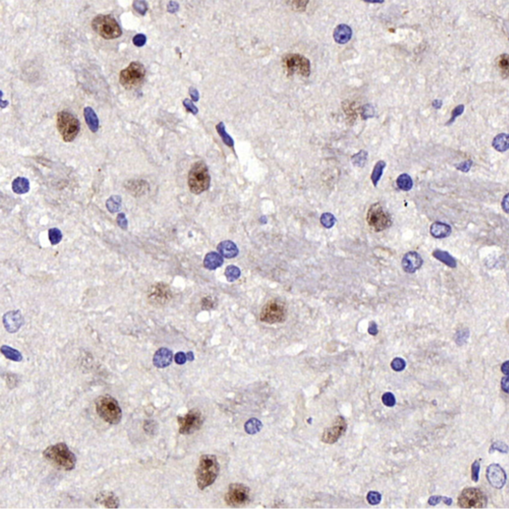 Immunohistochemistry analysis of paraffin-embedded Rat brain  using JNK1/2/3 Polyclonal Antibody at dilution of 1:200.