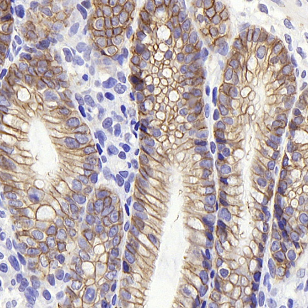 Immunohistochemistry analysis of paraffin-embedded Rat colon  using Na+/K+-ATPase alpha1 Polyclonal Antibody at dilution of 1:300.