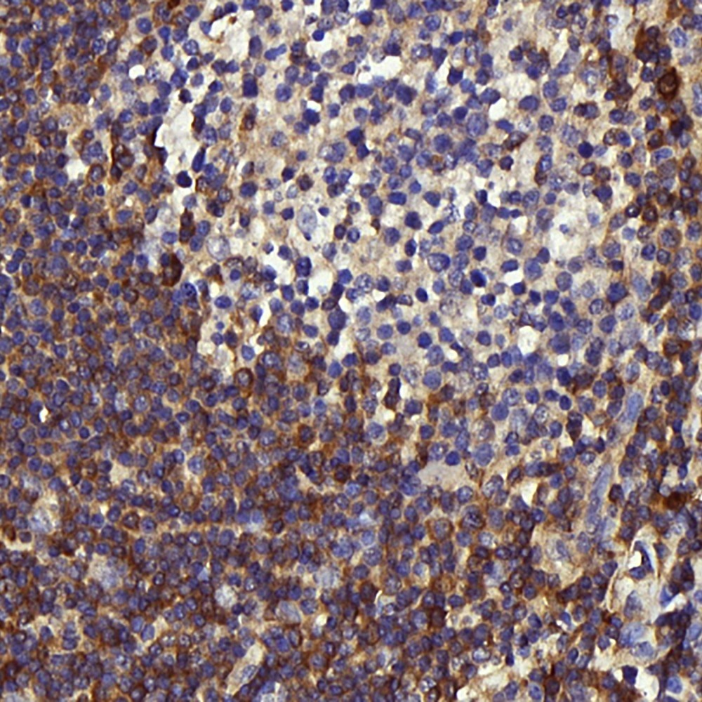 Immunohistochemistry analysis of paraffin-embedded human tonsil  using c-Kit Polyclonal Antibody at dilution of 1:200.