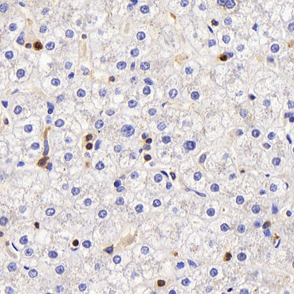 Immunohistochemistry analysis of paraffin-embedded human liver  using c-Kit Polyclonal Antibody at dilution of 1:200.