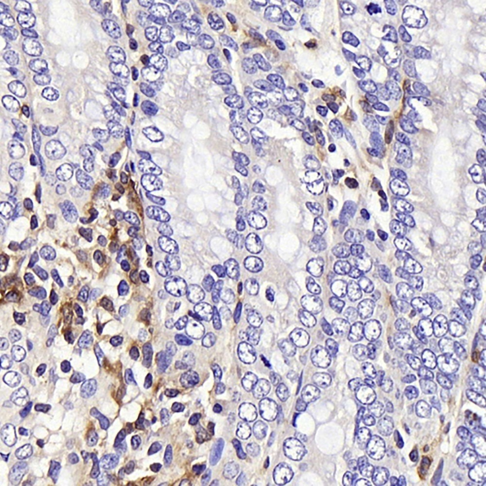 Immunohistochemistry analysis of paraffin-embedded rat colon  using c-Kit Polyclonal Antibody at dilution of 1:200.