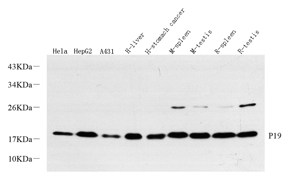 Western Blot analysis of various samples using p19 INK4d Polyclonal Antibody at dilution of 1:500.