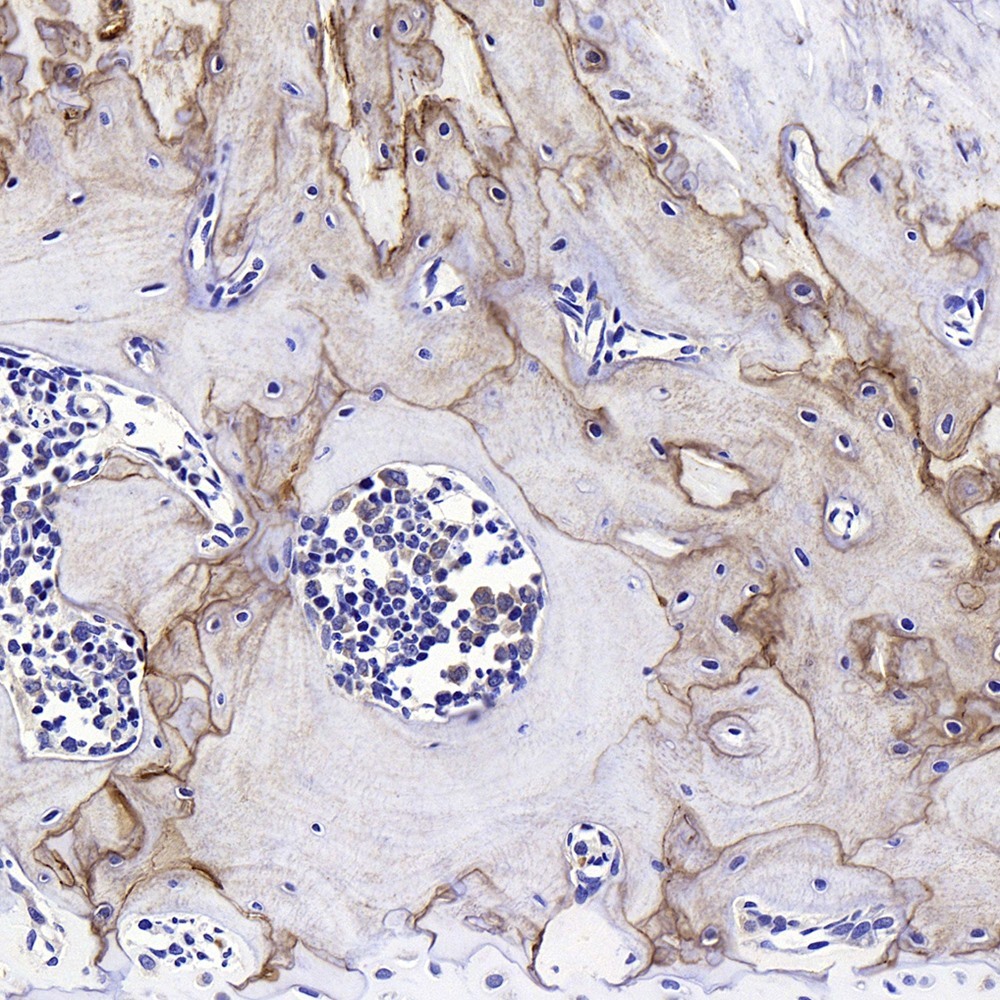 Immunohistochemistry analysis of paraffin-embedded rat bone  using SPP1 Polyclonal Antibody at dilution of 1:400.