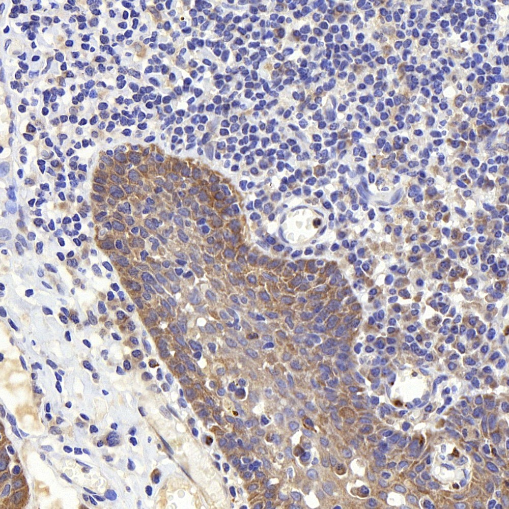 Immunohistochemistry analysis of paraffin-embedded human tonsil  using PERK Polyclonal Antibody at dilution of 1:400.