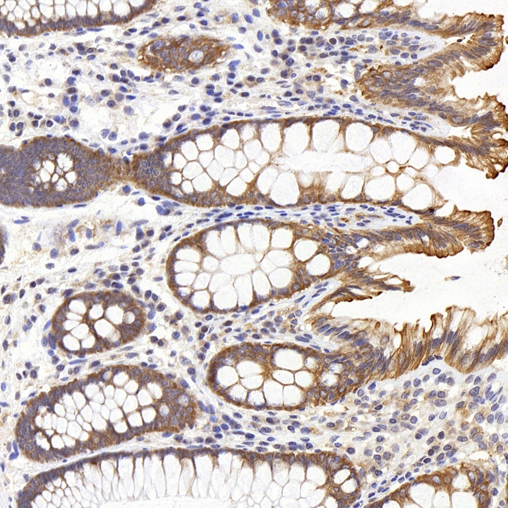 Immunohistochemistry analysis of paraffin-embedded human colon  using PERK Polyclonal Antibody at dilution of 1:500.