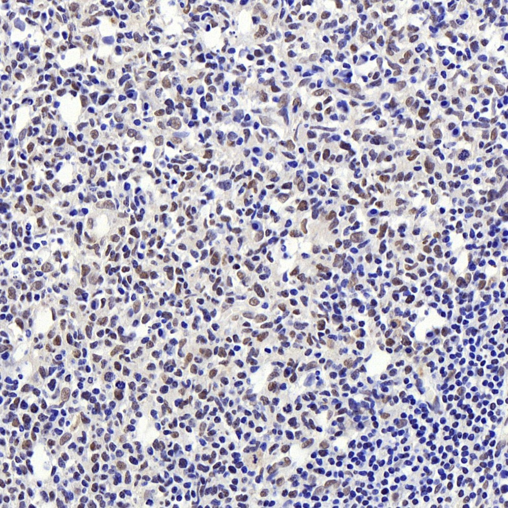 Immunohistochemistry analysis of paraffin-embedded human tonsil  using Histone H4 Polyclonal Antibody at dilution of 1:400.