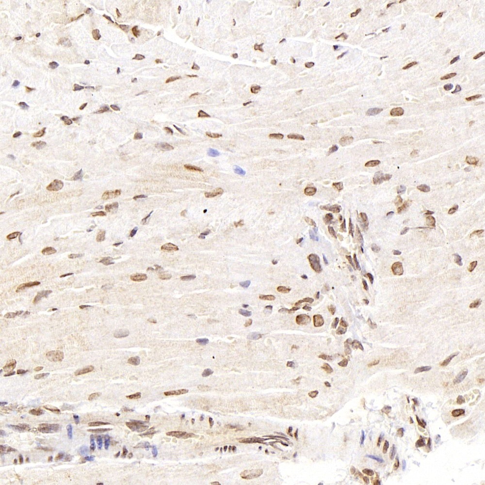 Immunohistochemistry analysis of paraffin-embedded mouse heart  using SMAD2 Polyclonal Antibody at dilution of 1:400.