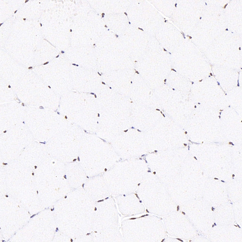 Immunohistochemistry analysis of paraffin-embedded rat skeletal muscle  using SMAD2 Polyclonal Antibody at dilution of 1:400.