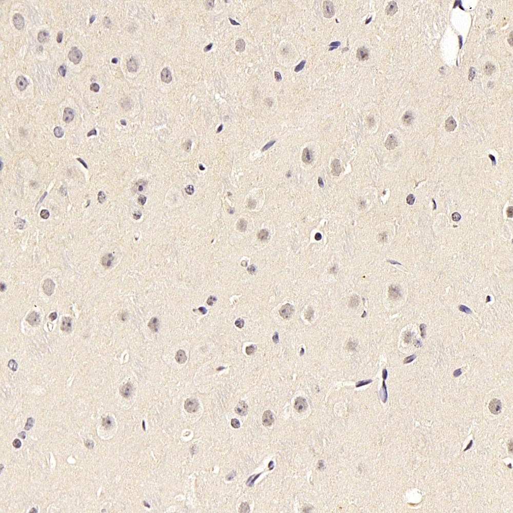 Immunohistochemistry analysis of paraffin-embedded mouse brain  using SIRT1 Polyclonal Antibody at dilution of 1:300.