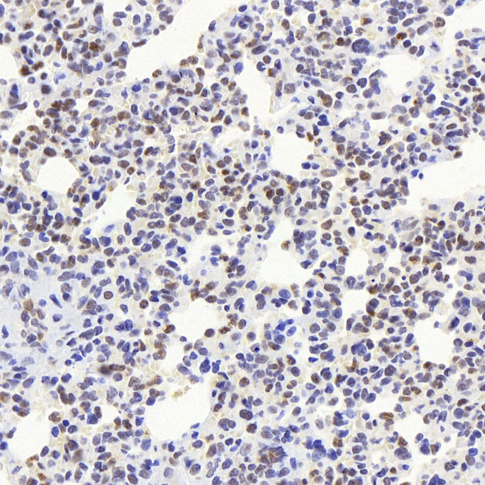 Immunohistochemistry analysis of paraffin-embedded rat lung  using JUN Polyclonal Antibody at dilution of 1:1000.