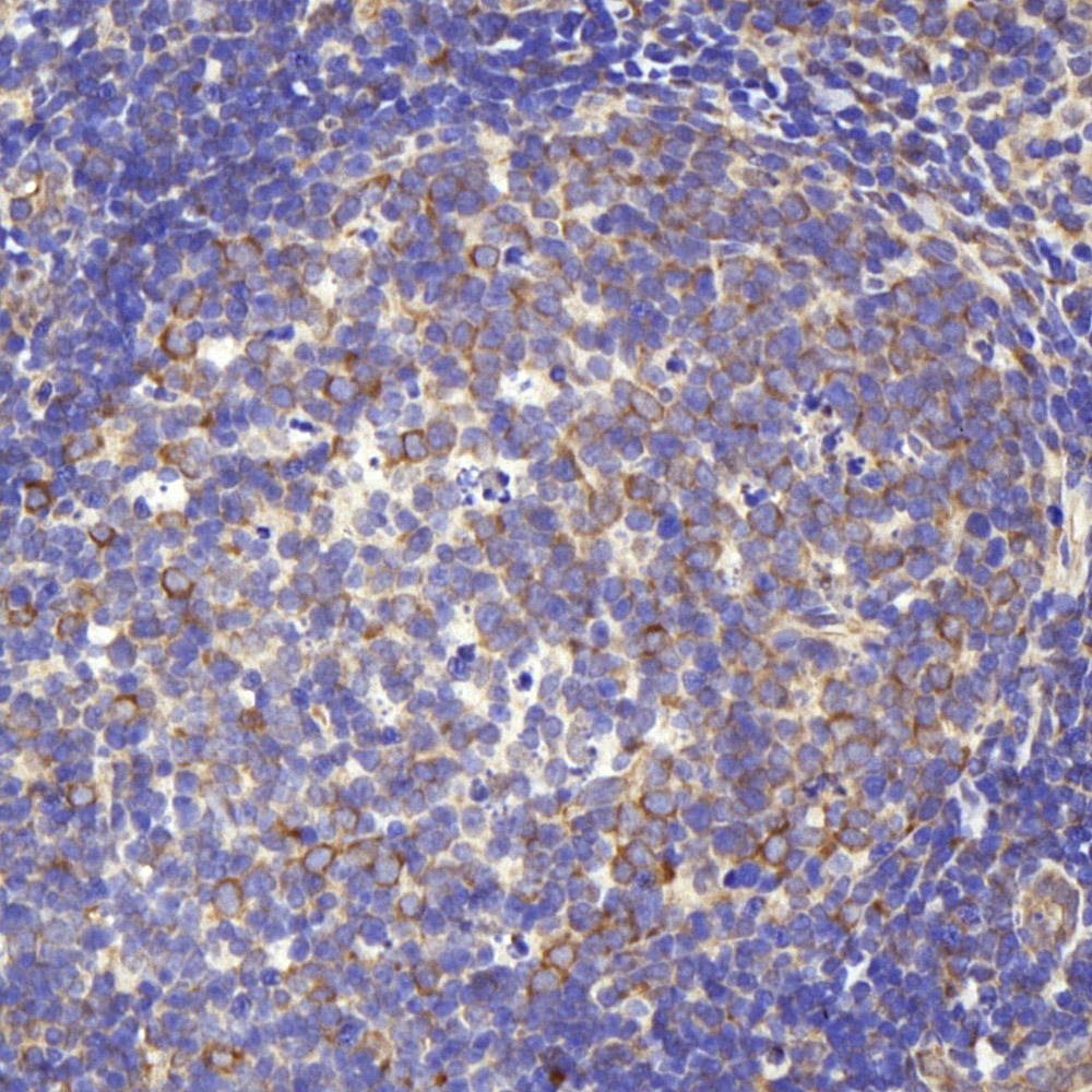 Immunohistochemistry analysis of paraffin-embedded rat lymph  using CD284 Polyclonal Antibody at dilution of 1:1000.