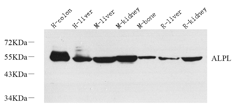 Western Blot analysis of various samples using ALPL Polyclonal Antibody at dilution of 1:1000.