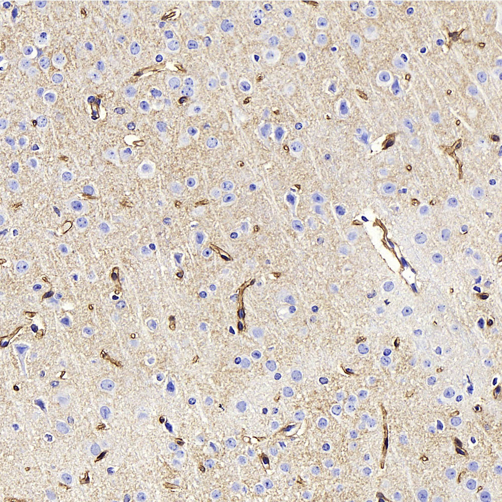 Immunohistochemistry analysis of paraffin-embedded Mouse brain  using AQP4 Polyclonal Antibody at dilution of 1:400.