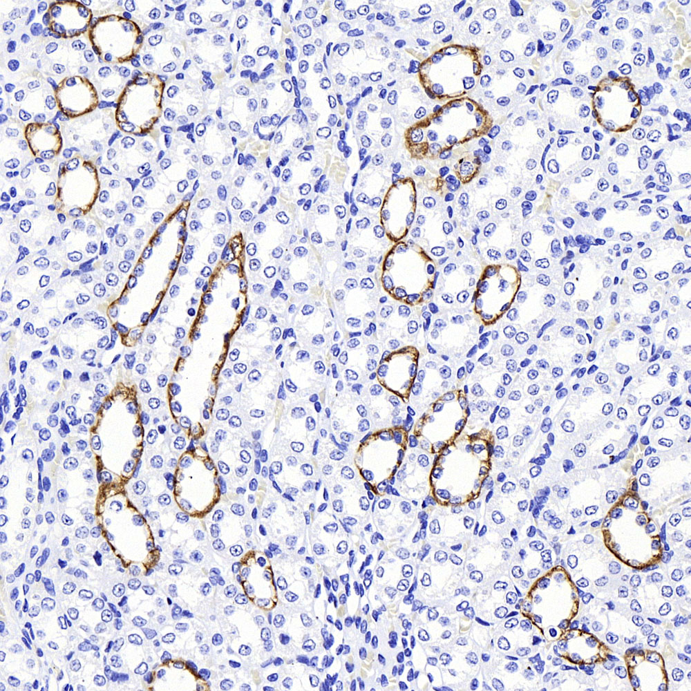 Immunohistochemistry analysis of paraffin-embedded rat kidney  using AQP4 Polyclonal Antibody at dilution of 1:400.