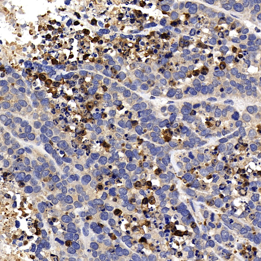 Immunohistochemistry analysis of paraffin-embedded A549 in Mouse Subcutaneous tumor  using CASP3 Polyclonal Antibody at dilution of 1:400.