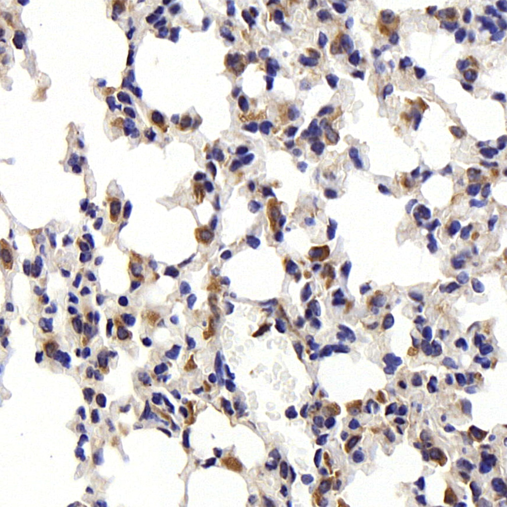 Immunohistochemistry analysis of paraffin-embedded mouse lung  using CD68 Polyclonal Antibody at dilution of 1:300.