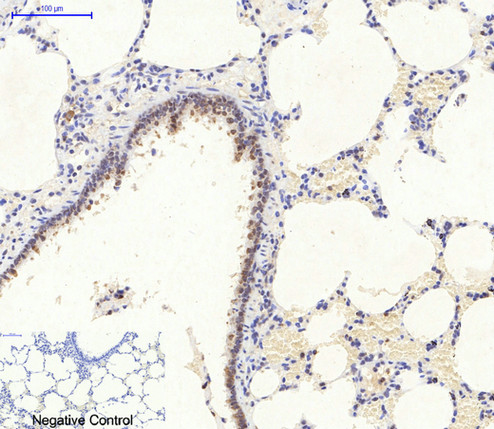 Immunohistochemistry of paraffin-embedded Rat lung tissue using AMPK alpha1/2 Polyclonal Antibody at dilution of 1:200.