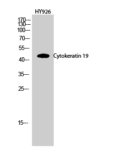 Western Blot analysis of HY926 cells using CK-19 Polyclonal Antibody at dilution of 1:1000.